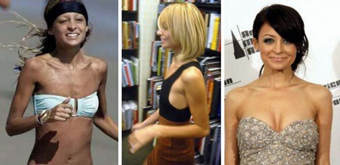 Celebs with Fake Breasts (14 pics)