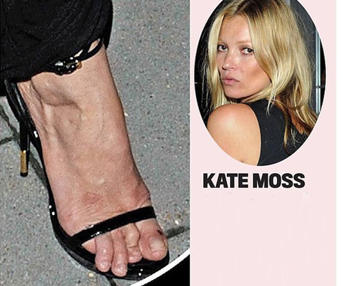 Celebrities with Ugly Feet (15 pics) .