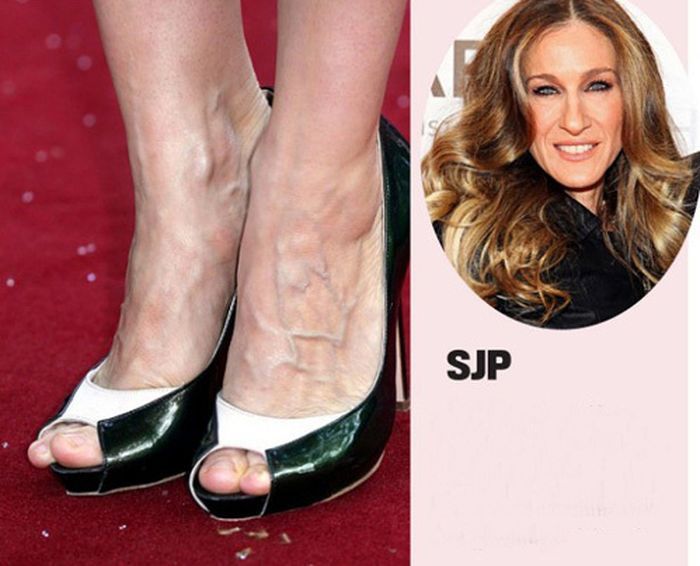 Celebrities with Ugly Feet (15 pics) .