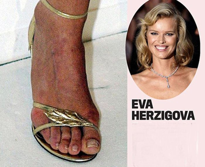 Celebrities with Ugly Feet (15 pics)