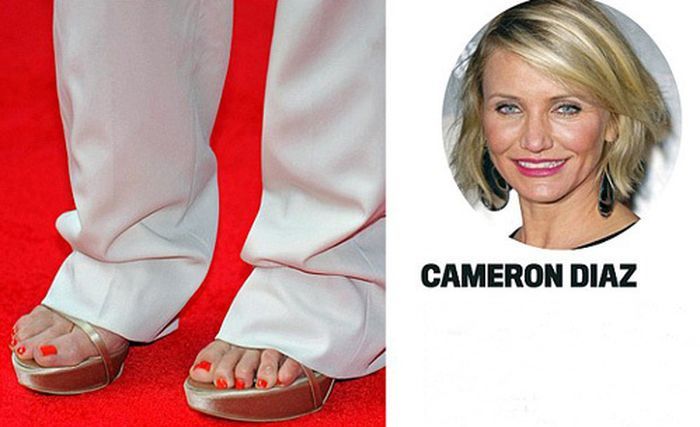 Celebrities with Ugly Feet (15 pics)