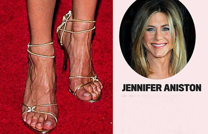 Most of these celebrities have pretty faces, but their feet don't look...