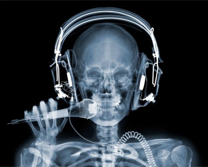 X-ray by Nick Veasey (56 pics)