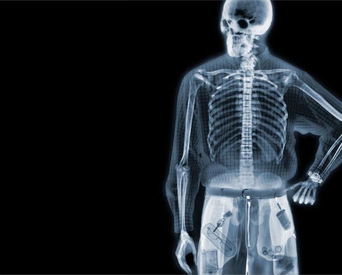 X-ray by Nick Veasey (56 pics)