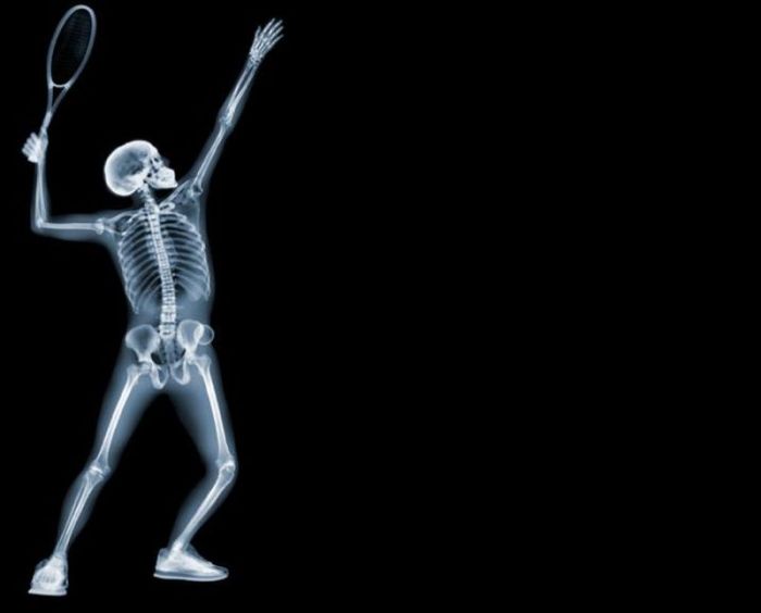 X-ray by Nick Veasey (56 pics)