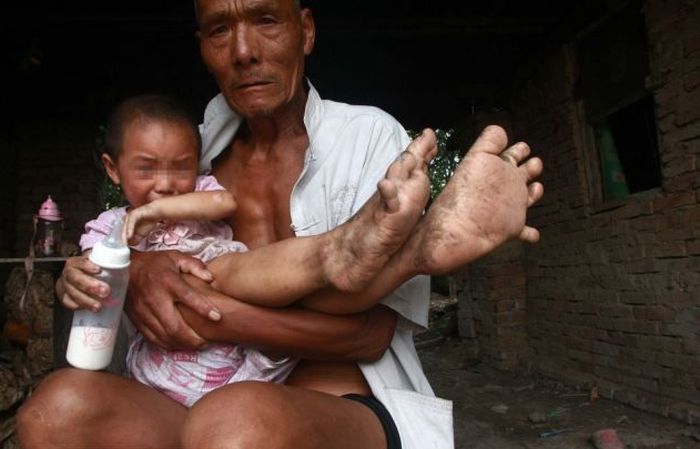Chinese Girl with Giant Feet (5 pics)