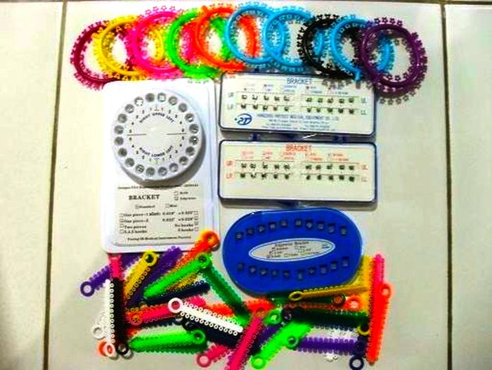 Braces Are New Trend in Asia (8 pics)