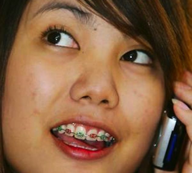 Braces Are New Trend in Asia (8 pics)