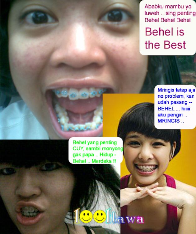 Braces Are New Trend in Asia (8 pics)
