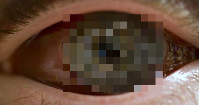 Eyeball Stitches (10 pics)