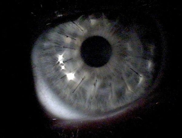 Eyeball Stitches (10 pics)