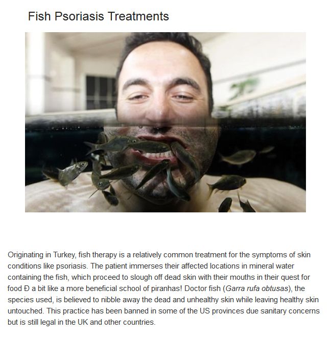 Bizarre Medical Treatments Involving Animals (10 pics)