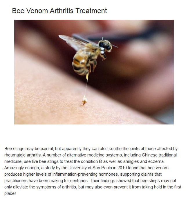Bizarre Medical Treatments Involving Animals (10 pics)