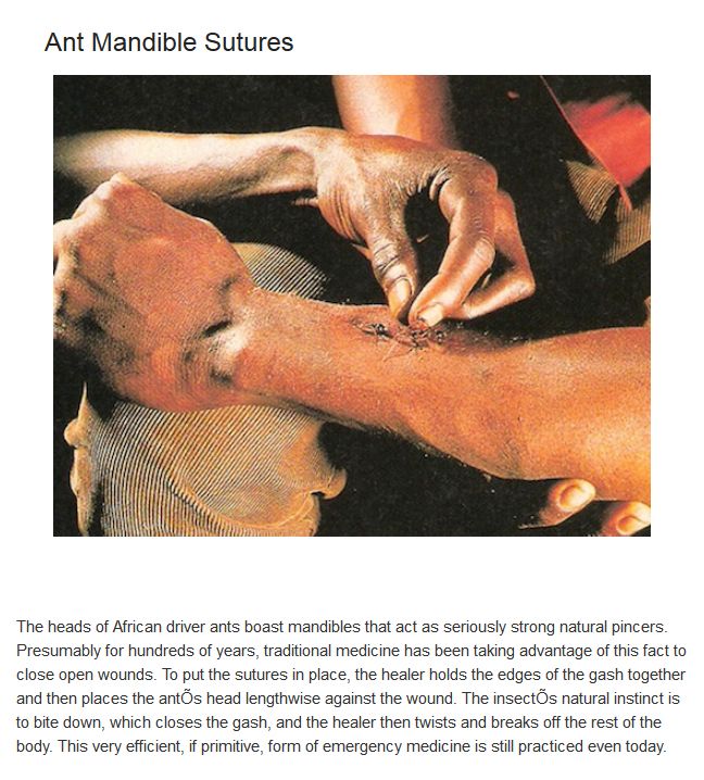 Bizarre Medical Treatments Involving Animals (10 pics)