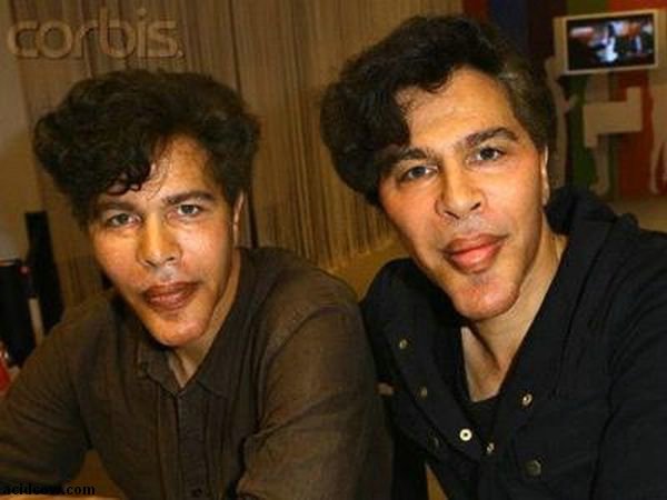 Plastic Surgery Disaster (42 pics)
