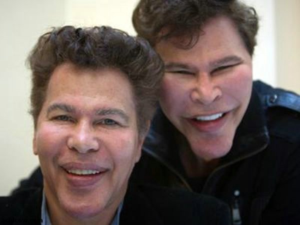 Plastic Surgery Disaster (42 pics) Plastic Surgery Disaster (42 pics)