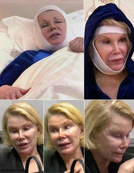 Plastic Surgery Disaster (42 pics)