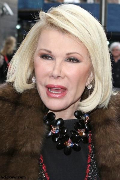 Plastic Surgery Disaster (42 pics) Plastic Surgery Disaster (42 pics)