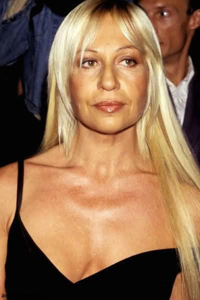 Plastic Surgery Disaster (42 pics)