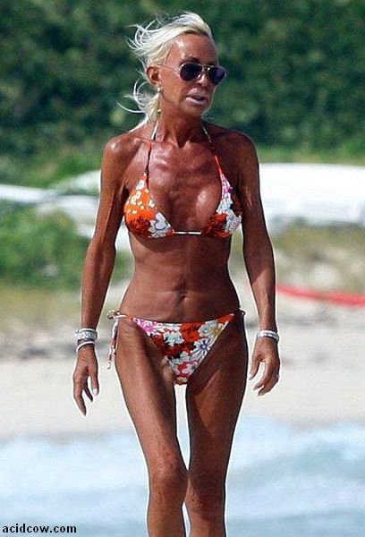 Plastic Surgery Disaster (42 pics)