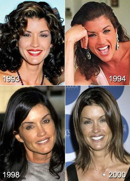 Plastic Surgery Disaster (42 pics)