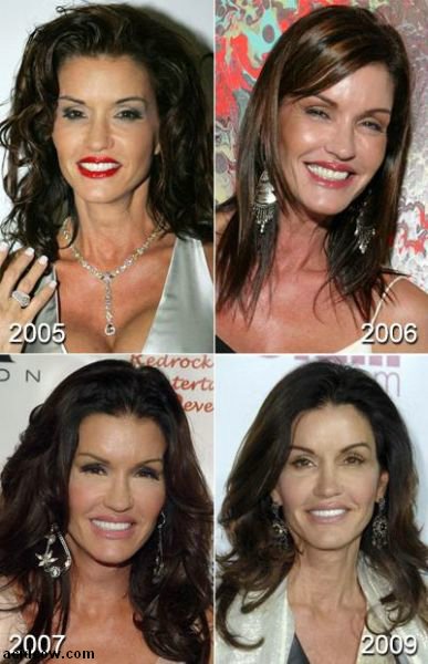 Plastic Surgery Disaster (42 pics)