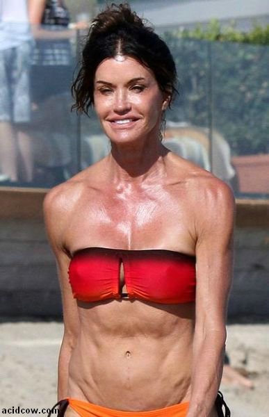Plastic Surgery Disaster (42 pics)