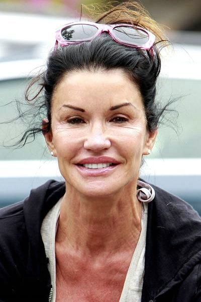 Plastic Surgery Disaster (42 pics) Plastic Surgery Disaster (42 pics)
