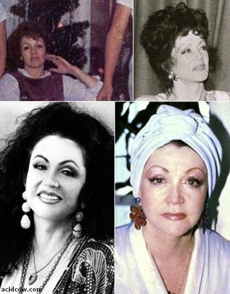 Plastic Surgery Disaster (42 pics)