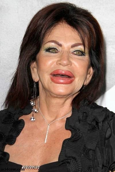 Plastic Surgery Disaster (42 pics)