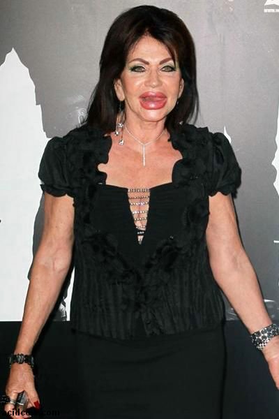 Plastic Surgery Disaster (42 pics) Plastic Surgery Disaster (42 pics)