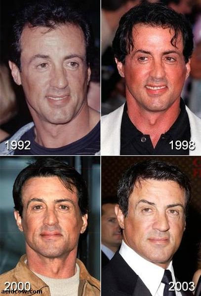 Plastic Surgery Disaster (42 pics)