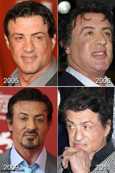 Plastic Surgery Disaster (42 pics)