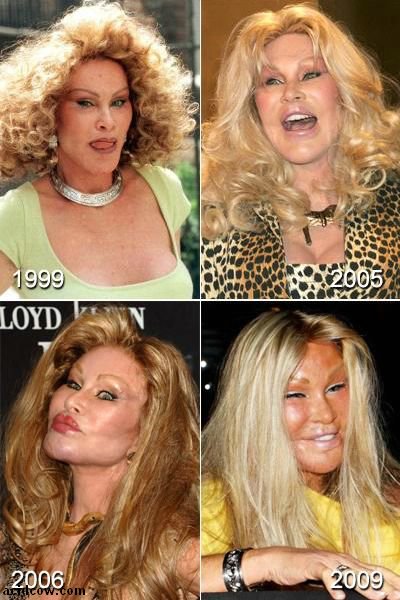 Plastic Surgery Disaster (42 pics)