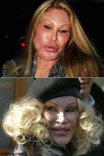 Plastic Surgery Disaster (42 pics)