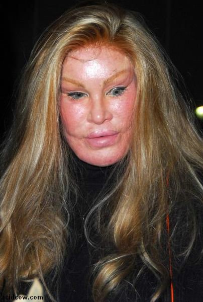 Plastic Surgery Disaster (42 pics)
