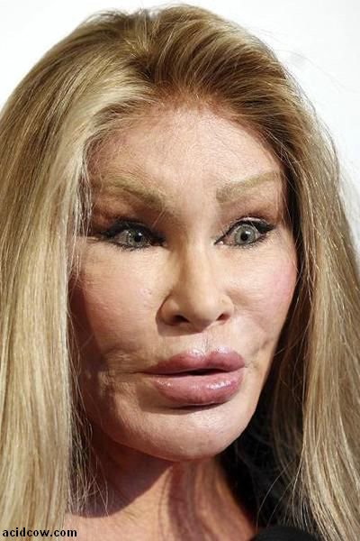 Plastic Surgery Disaster (42 pics)