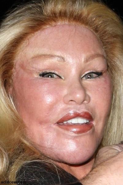 Plastic Surgery Disaster (42 pics)