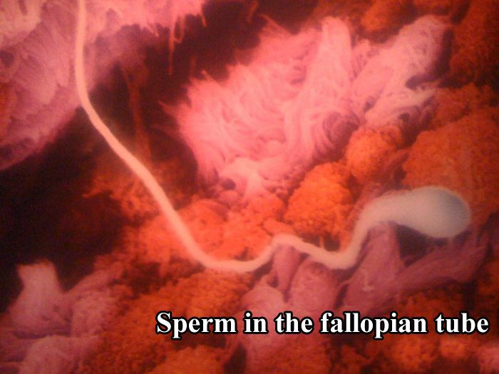 The First 26 Weeks of a Fetus (16 pics)