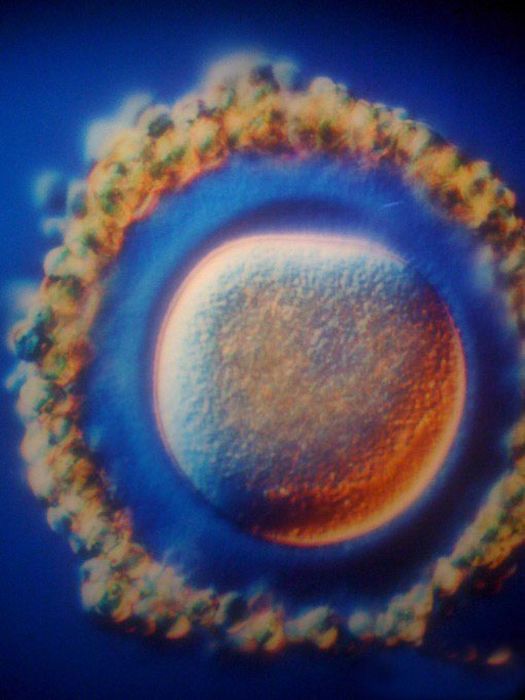 The First 26 Weeks of a Fetus (16 pics)
