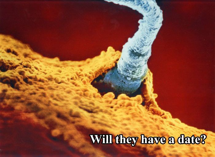 The First 26 Weeks of a Fetus (16 pics)