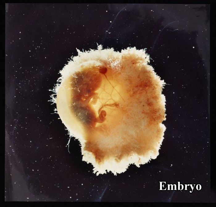 The First 26 Weeks of a Fetus (16 pics)