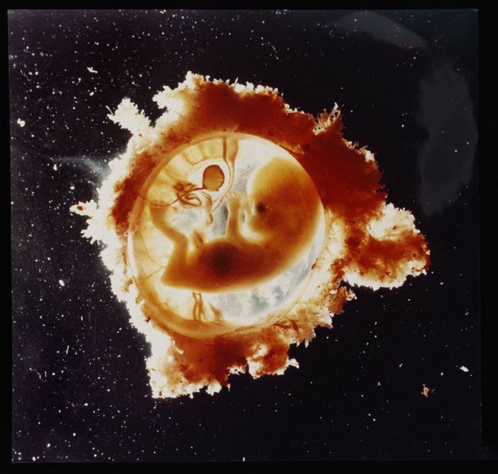 The First 26 Weeks of a Fetus (16 pics)