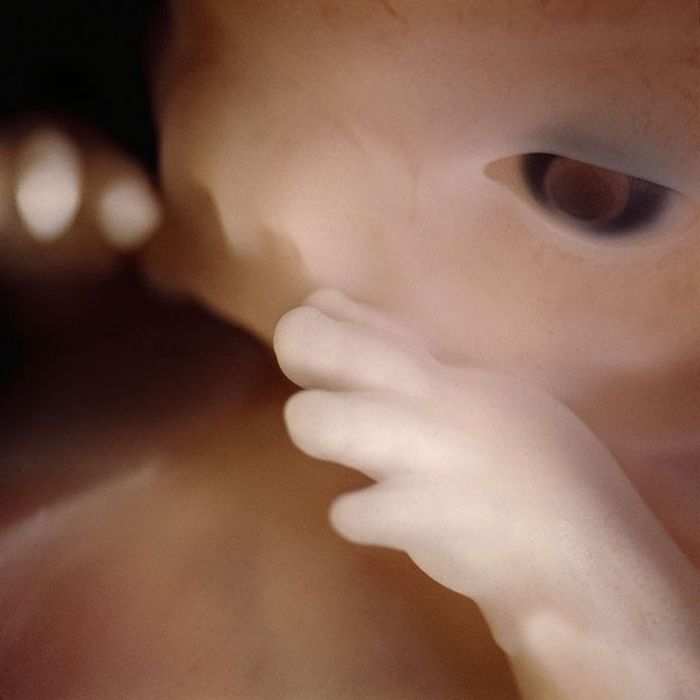 The First 26 Weeks of a Fetus (16 pics)
