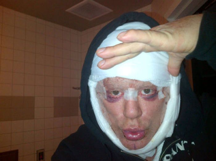 Mickey Rourke After a Plastic Surgery (7 pics)