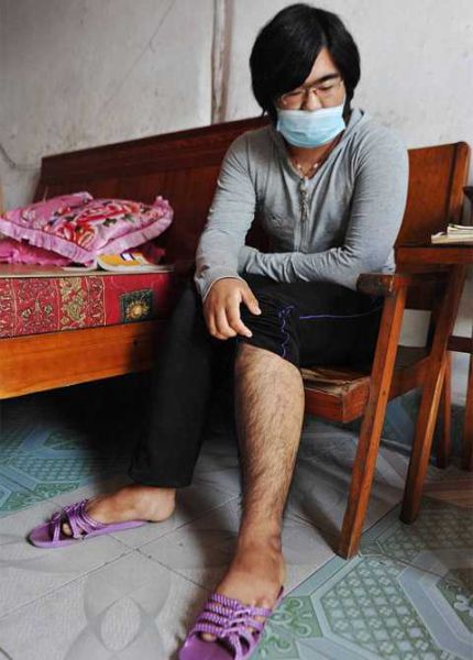 Unexpected Side Effects (10 pics)