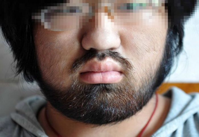 Unexpected Side Effects (10 pics)