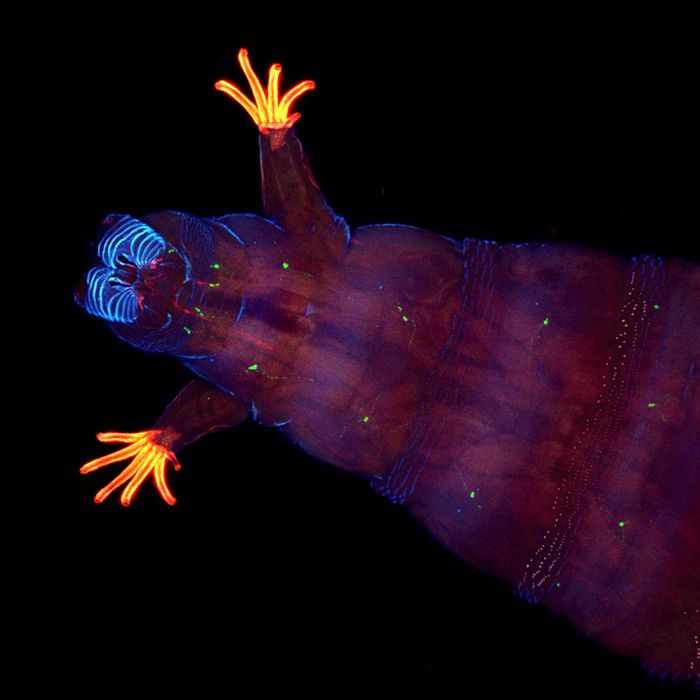 Creepy Microscope Close-Ups (17 pics) Creepy Microscope Close-Ups (17 pics)