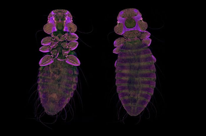 Creepy Microscope Close-Ups (17 pics) Creepy Microscope Close-Ups (17 pics)