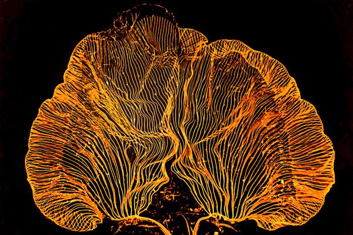 Creepy Microscope Close-Ups (17 pics) Creepy Microscope Close-Ups (17 pics)